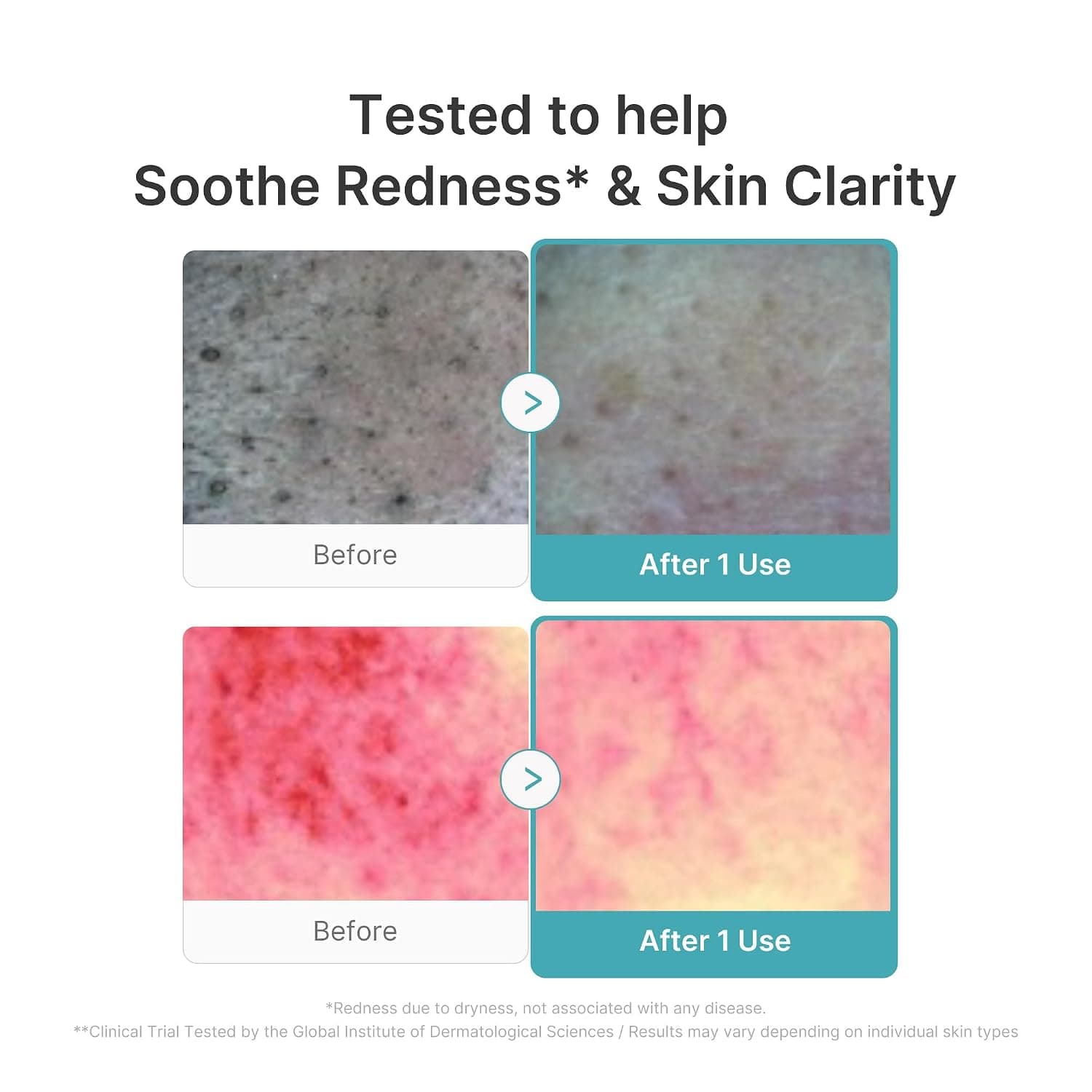 medicube Azelaic + Niacinamide Foam Cleanser
